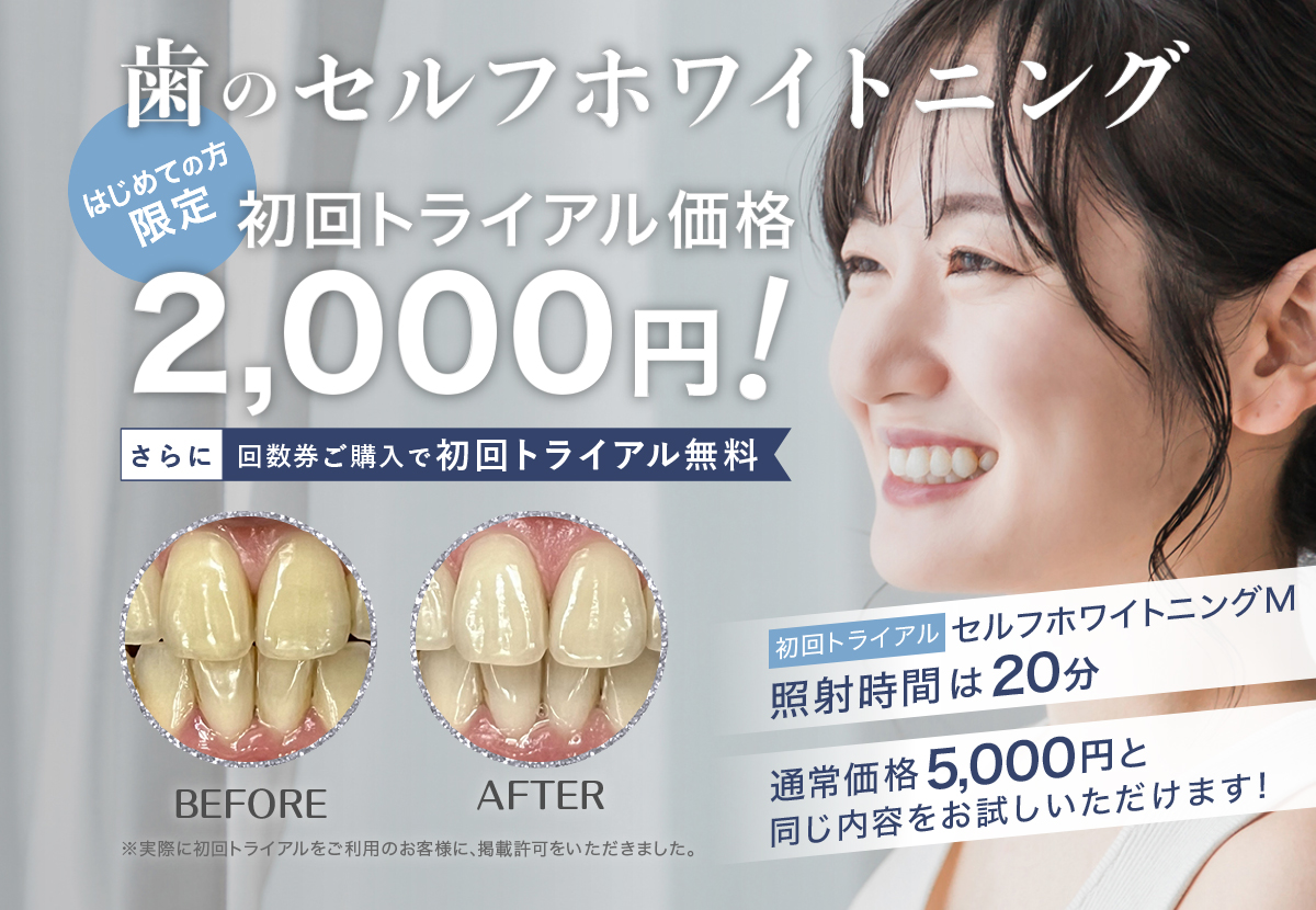 歯のセルフホワイトニング はじめての方限定！初回トライアル2,000円！さらに回数券ご購入で初回トライアル無料！